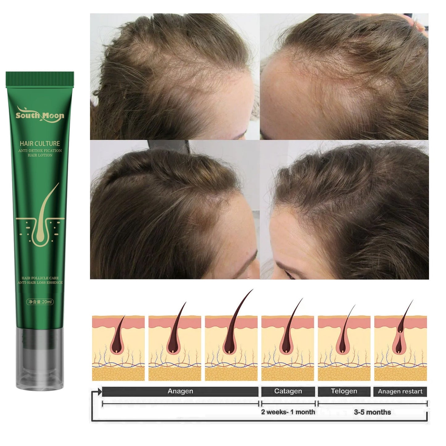 Anti Hair Loss Serum💗Hair Grows Thicker And Thicker 💖
