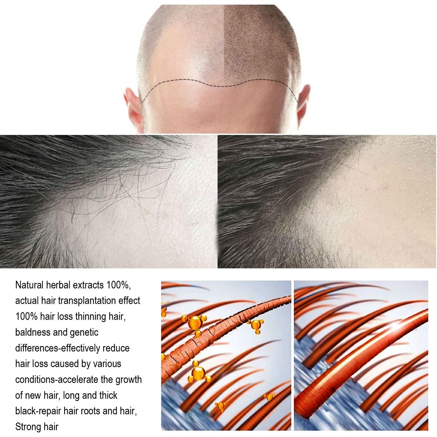 Anti Hair Loss Serum💗Hair Grows Thicker And Thicker 💖