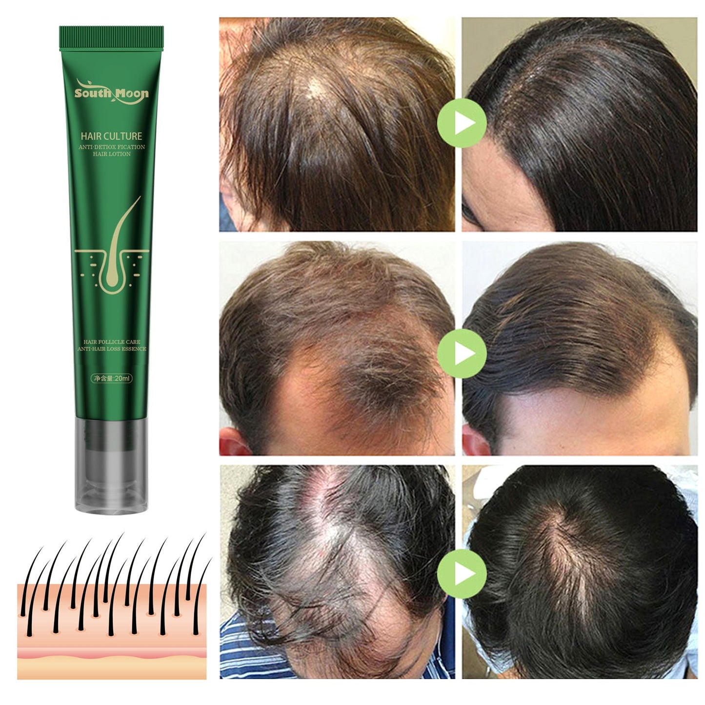 Anti Hair Loss Serum💗Hair Grows Thicker And Thicker 💖