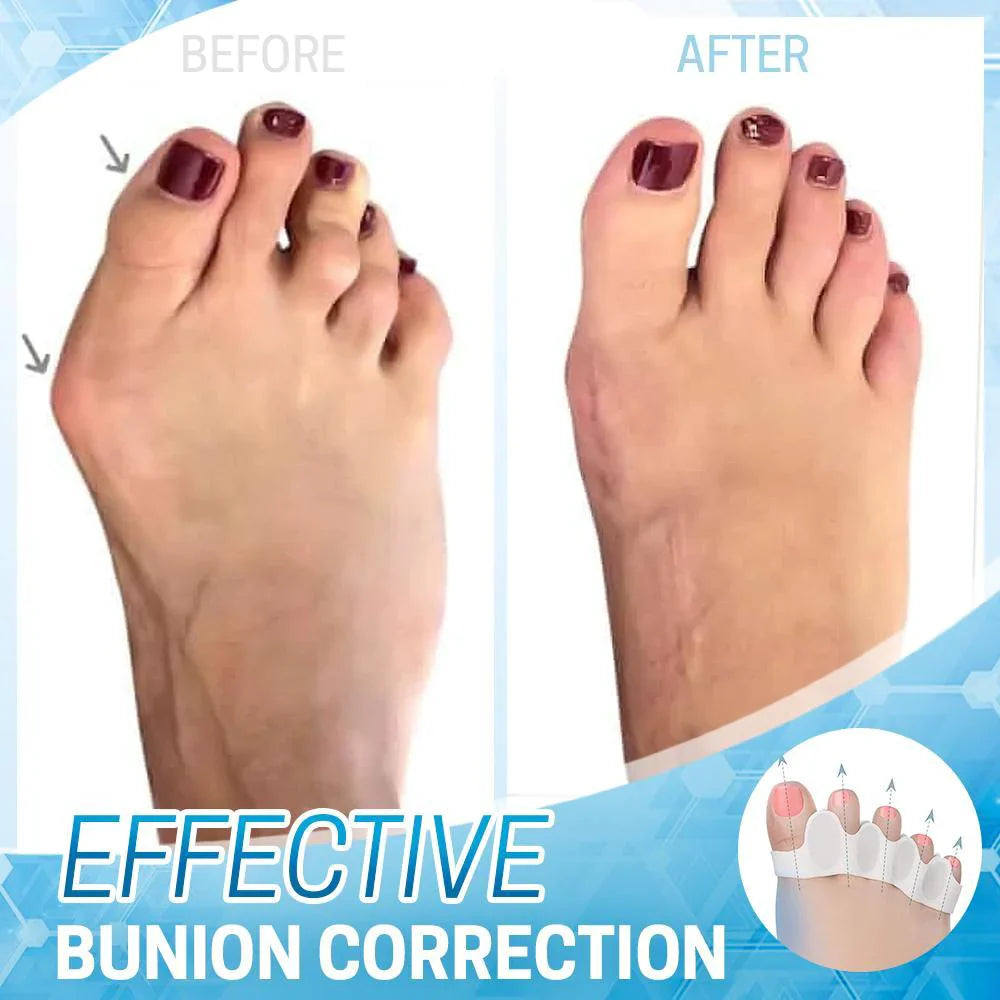 Silicone Bunion Corrector