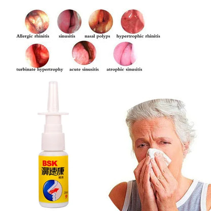 20ml Spray Nasal Cure Rhinitis Sinusitis Nose Spray