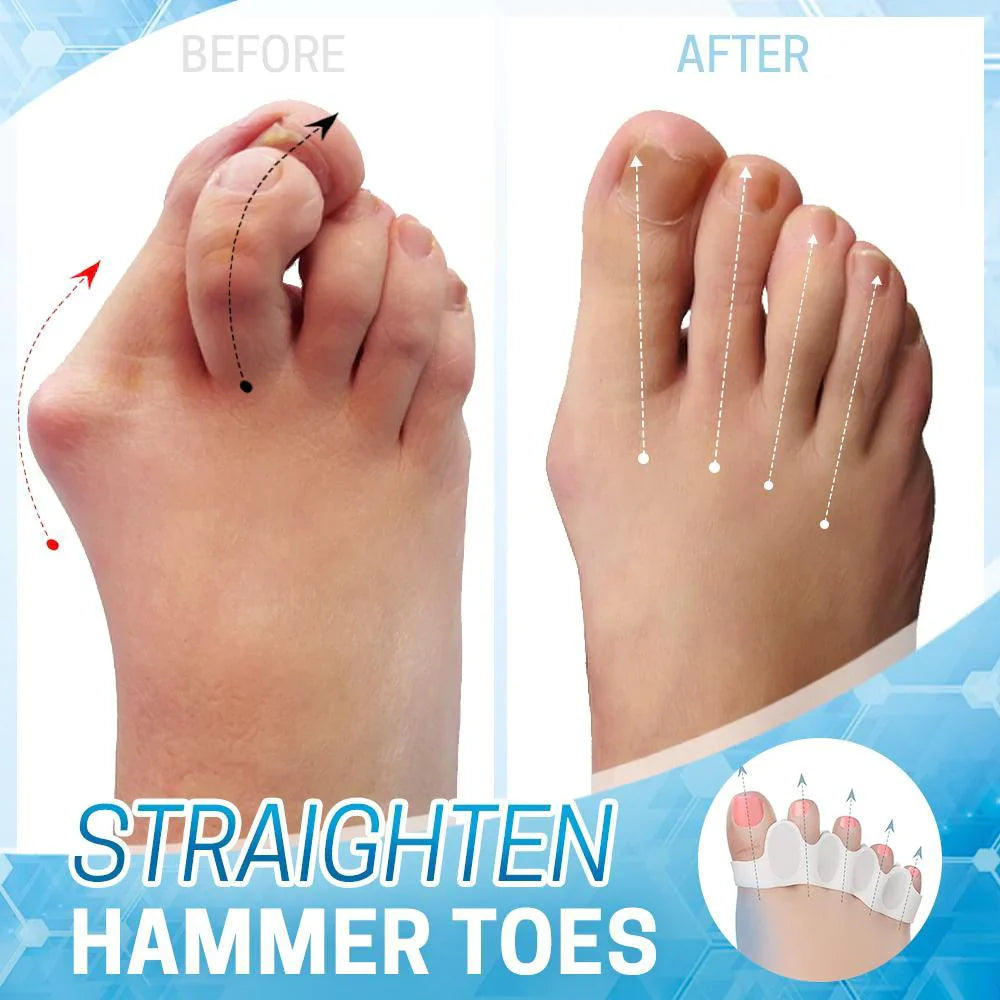 Silicone Bunion Corrector