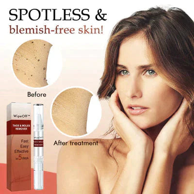 Skin Spots Warts Remover Facial Cleaning Pen