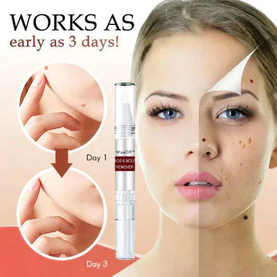Skin Spots Warts Remover Facial Cleaning Pen