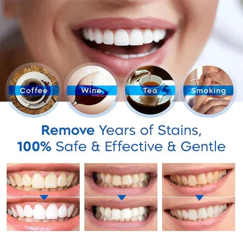 ✨TEETH WHITENING ESSENCE🔥HOT SALE🔥