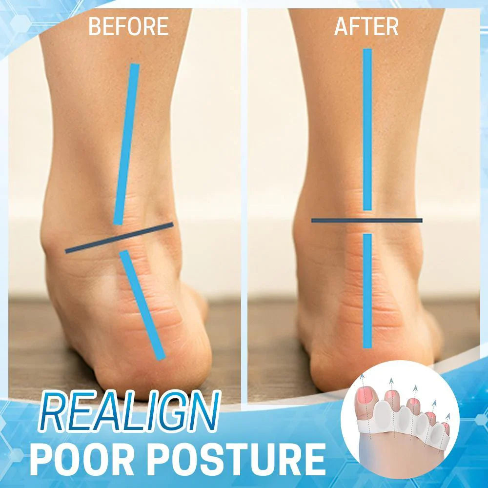 Silicone Bunion Corrector